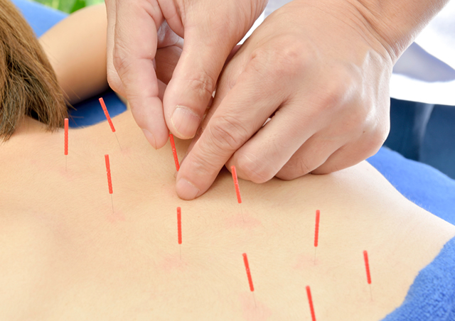 柔整・鍼灸